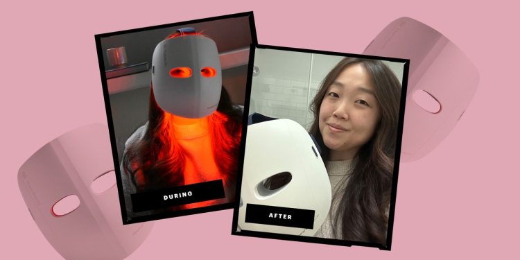 Is the TheraFace Mask Glo Worth It? One Editor Finds Out—Review With Photos