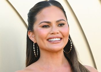 Chrissy Teigen Lost a Veneer, But She’s Still Smiling — See Photos