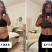 I Got Skin Removal Surgery After Losing 230 Pounds On a GLP-1