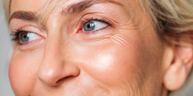 The Best Concealer Hacks for Fine Lines, According to Makeup Artists