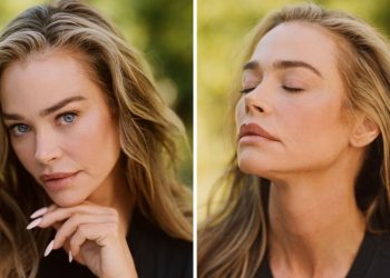 Denise Richards Shares Facelift Results With Before-and-After Photos