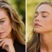 Denise Richards Shares Facelift Results With Before-and-After Photos
