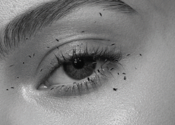 Irritated Eyes? You Might Have Mites in Them