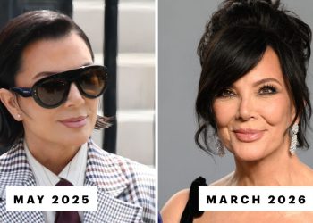 Is Kris Jenner’s Facelift Really Already “Slipping”?