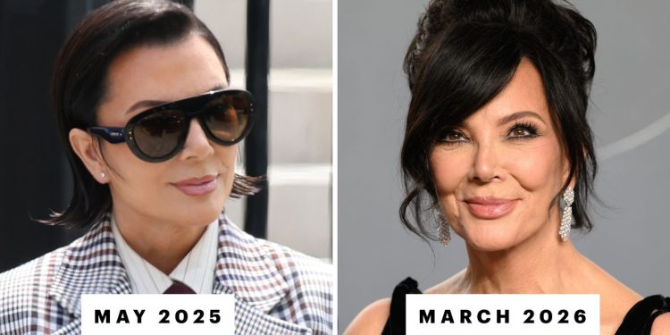 Is Kris Jenner’s Facelift Really Already “Slipping”?