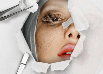 I Spent a Week As My Friend’s Facelift Nurse. Here’s What No One Tells You.