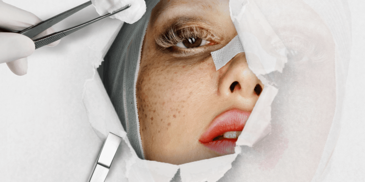 I Spent a Week As My Friend’s Facelift Nurse. Here’s What No One Tells You.