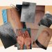 11 Common Skin Conditions on Dark Skin and How to Treat Them