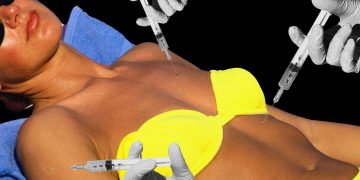 No, You Shouldn’t Inject a Peptide to Get Tan