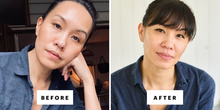 What Happened After I Quit Botox, Fillers, Lasers, and GLP-1s