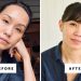 What Happened After I Quit Botox, Fillers, Lasers, and GLP-1s