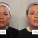 Can You Fake a Blepharoplasty? I Gave It My Best Shot