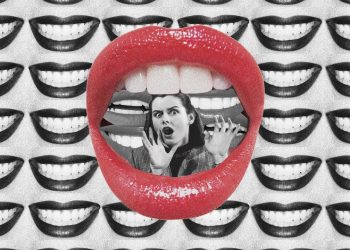 Veneer Regret Is Real. Here’s What’s Causing Buyer’s Remorse.