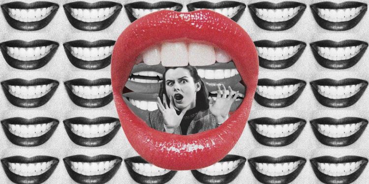 Veneer Regret Is Real. Here’s What’s Causing Buyer’s Remorse.